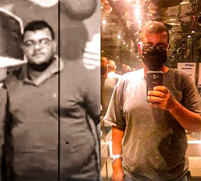 Before and after transformation 11 - Emagrecentro Orlando