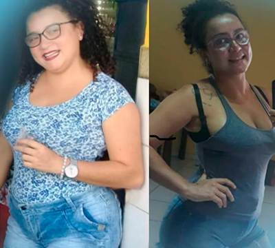 Before and after transformation 28 - Emagrecentro Orlando