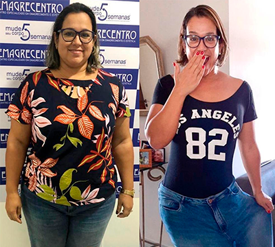 Before and after transformation 29 - Emagrecentro Orlando