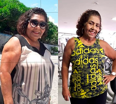 Before and after transformation 1 - Emagrecentro Orlando