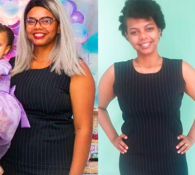 Before and after transformation 3 - Emagrecentro Orlando