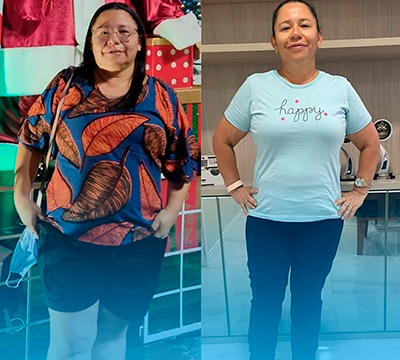 Before and after transformation 5 - Emagrecentro Orlando