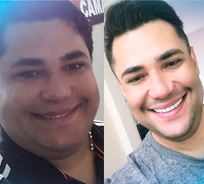 Before and after transformation 20 - Emagrecentro Orlando