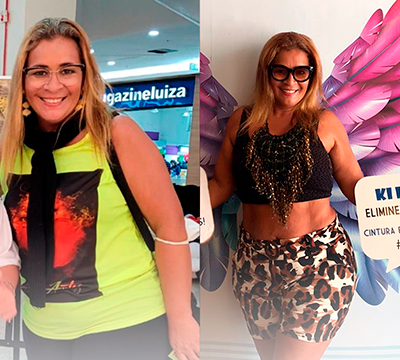 Before and after transformation 12 - Emagrecentro Orlando