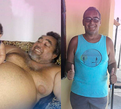 Before and after transformation 13 - Emagrecentro Orlando