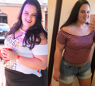 Before and after transformation 14 - Emagrecentro Orlando