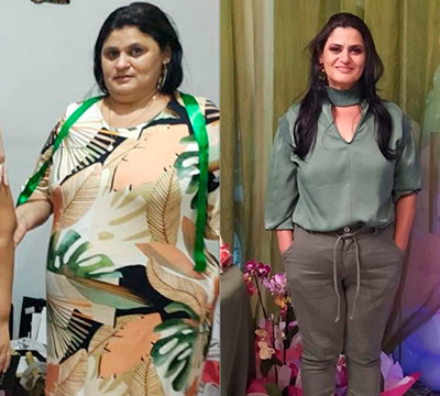 Before and after transformation 30 - Emagrecentro Orlando