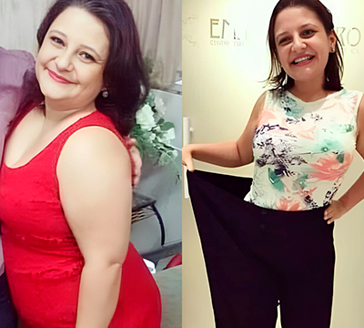 Before and after transformation 31 - Emagrecentro Orlando