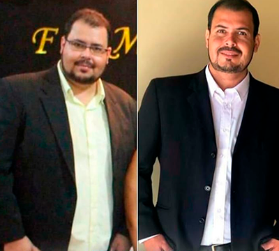 Before and after transformation 22 - Emagrecentro Orlando