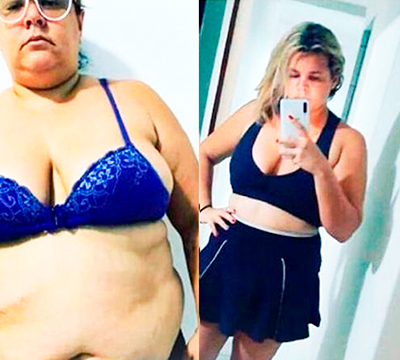 Before and after transformation 24 - Emagrecentro Orlando