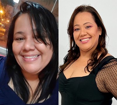 Before and after transformation 25 - Emagrecentro Orlando