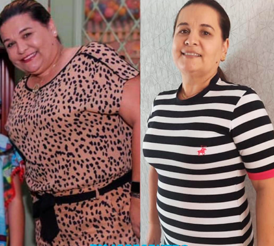 Before and after transformation 26 - Emagrecentro Orlando