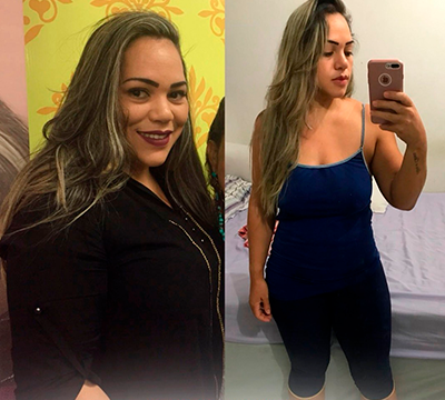 Before and after transformation 27 - Emagrecentro Orlando